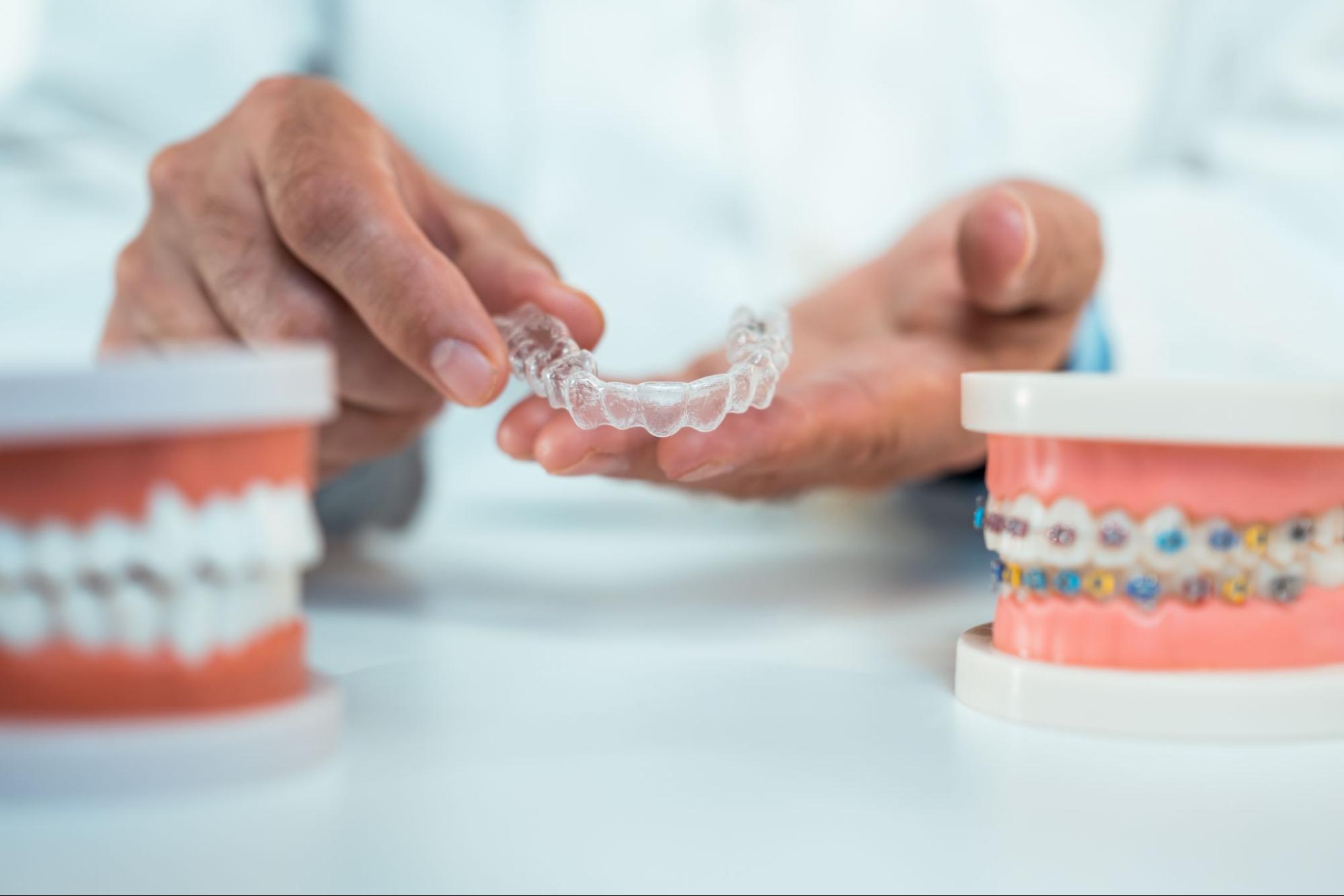 Why Retainer Wear Is More Important Than Braces
